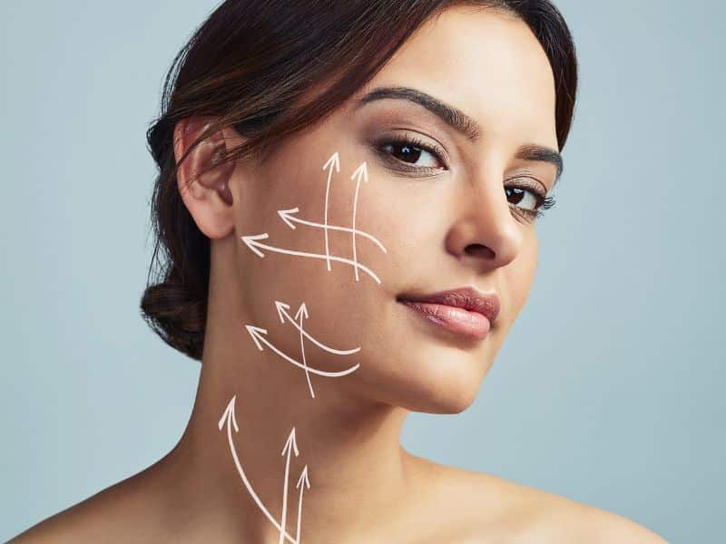 Lifting facial sin cirugía con hilos tensores, direcciones de tensado en el rostro